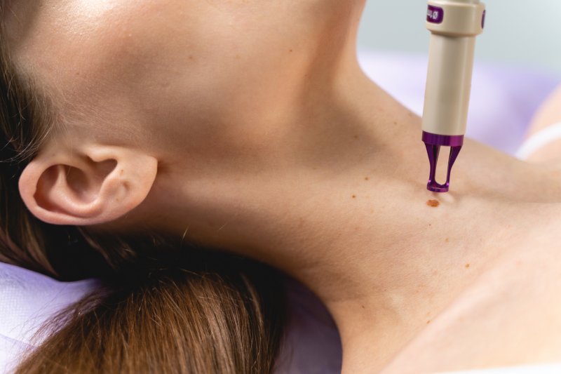 Resultados tratamiento lesiones cutaneas